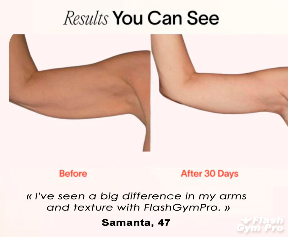 FlashGymPro™ Arm Bands - 2 pcs. (Proven Red Light Terapy)